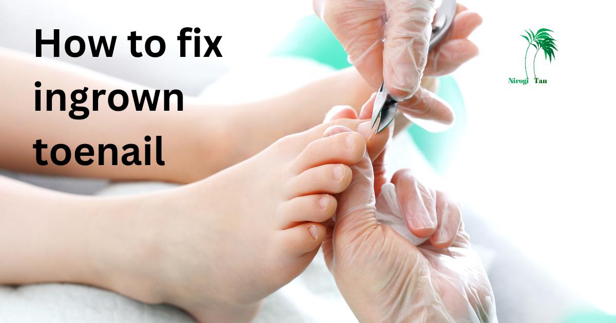 how-to-fix-ingrown-toenail-nirogi-tan