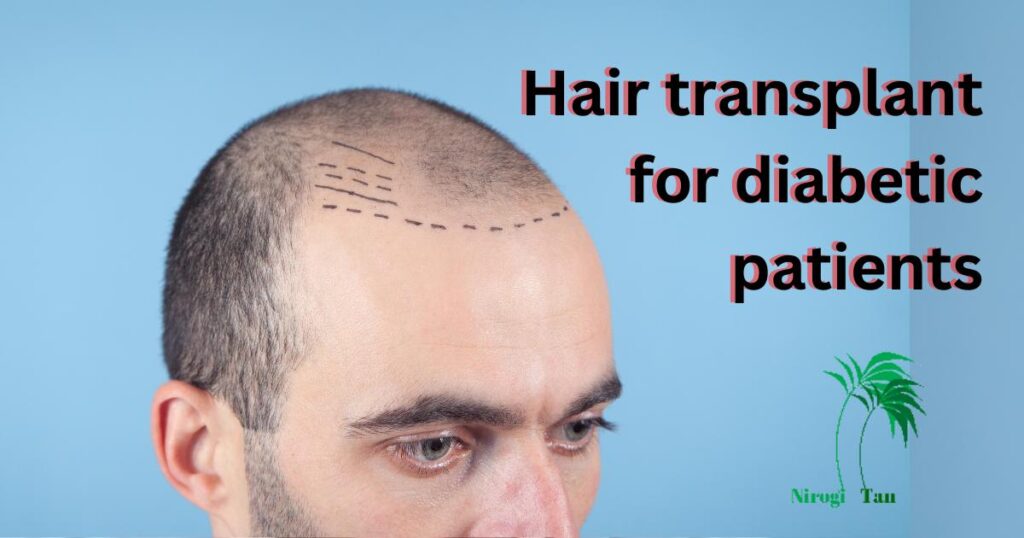 Hair transplant for diabetic patients